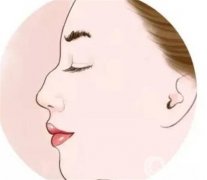 駝峰鼻矯正有什么優(yōu)點(diǎn)和缺點(diǎn)