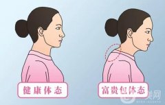 富貴包有什么危害和影響？