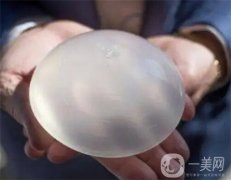 娜高乳胸假體怎么樣？好不好？哪些人不適合