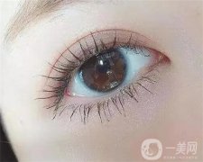眼袋手術(shù)后需要多長(zhǎng)時(shí)間恢復(fù)？