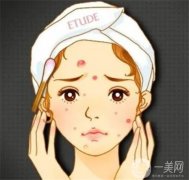有哪些類型的？做激光會(huì)損傷皮膚嗎？