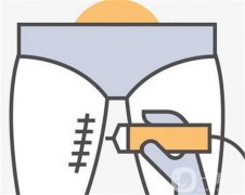 夏天抽脂恢復需要多長時間?夏天能做抽脂嗎?