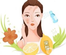 多久需要做一次果酸換膚？