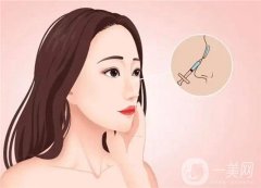 玻尿酸隆鼻后如何保養(yǎng)呢？