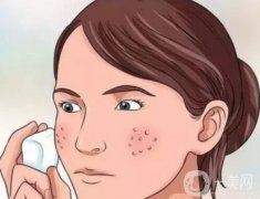 毛孔粗大是什么原因？什么因素影響激光收縮毛孔的價(jià)格？