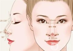 鼻翼內(nèi)切好還是外切比較好？