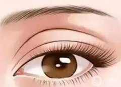 填充眼窩的果可以維持多久？