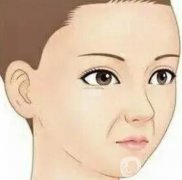 去除法令紋有哪些方法？