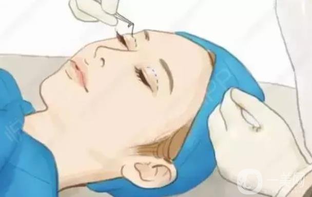 眼部整形的下眼下至術(shù)前準(zhǔn)備工作主要有哪些？
