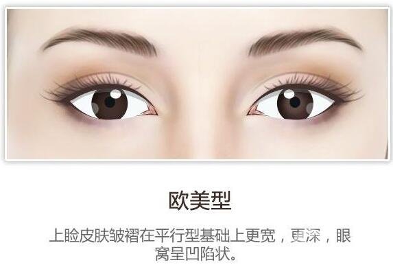 開(kāi)眼角后疤痕增生怎么辦？