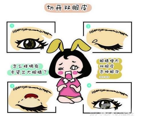 雙眼皮