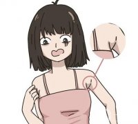 副乳切除后會不會影響淋巴？