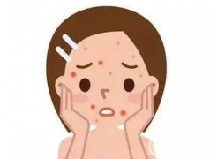點(diǎn)陣激光祛痘印有果嗎？果好嗎？