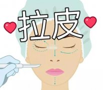 電波拉皮的果可以管很久嗎？