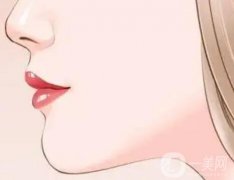 不同墊下巴的材料有什么不同？