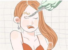 割雙眼皮消腫需要多長時間?