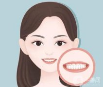 地包天是怎么形成的？應(yīng)該如何糾正？