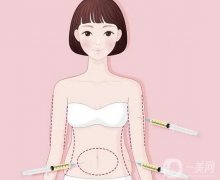 抽脂后為什么沒(méi)有變瘦？