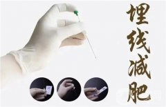 埋線減肥有什么特點？注意事項有哪些？