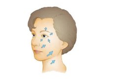 金線齒狀線除皺手術有什么優(yōu)勢