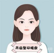 割雙眼皮后怎么做能夠很快恢復?