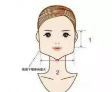 磨下頜角有哪些優(yōu)點？需要多長時間恢復？