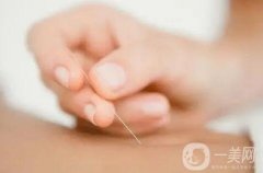 埋線減肥有哪些禁忌？可以吃辣嗎？