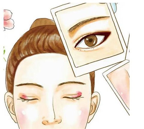 割雙眼皮疼嗎？有多疼？