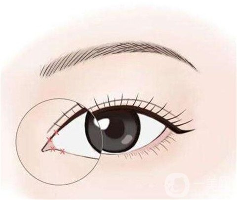 開(kāi)內(nèi)眼角多久可以化妝？