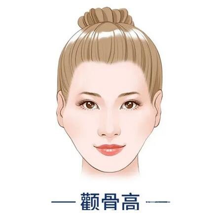 顴骨內推注意事項詳情介紹