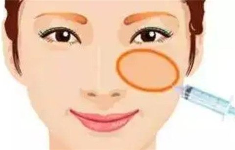 一針*能打兩邊嗎？