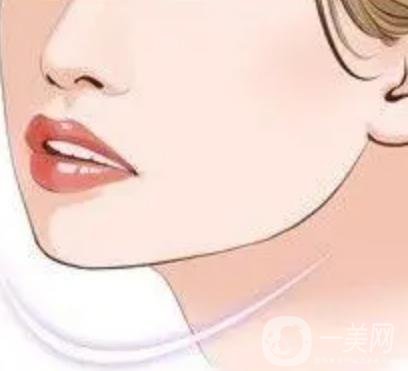 玻尿酸填充下巴有什么副作用嗎？
