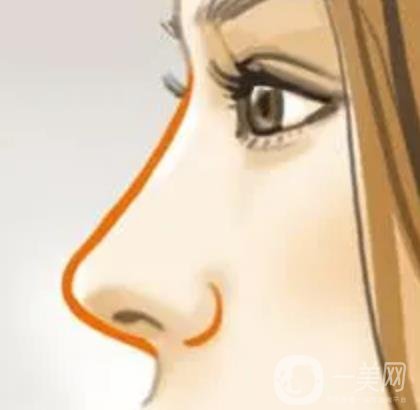 南京醫(yī)科大學(xué)友誼醫(yī)院整形外科價(jià)格表，附隆鼻案例圖