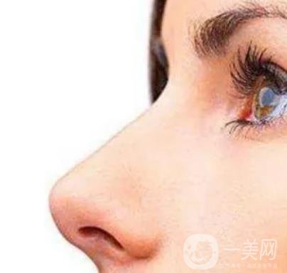 玻尿酸隆鼻價格是多少 玻尿酸隆鼻方法