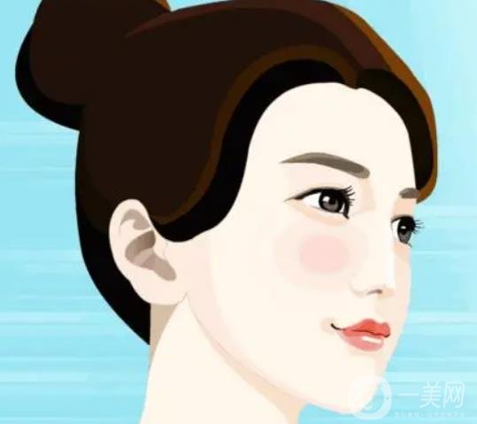 假體下巴多久恢復(fù)？恢復(fù)過(guò)程怎樣的？