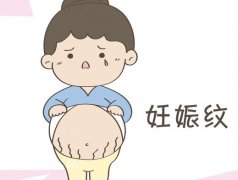激光去除妊娠紋真的有嗎？有什么果？