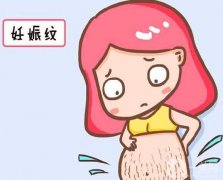 去除妊娠紋有哪些方法？激光去除妊娠紋有什么優(yōu)勢