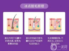 脫毛全攻略，拒絕毛手毛腳