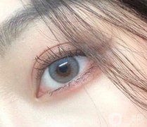 別大意:雙眼皮不是隨便割割就好