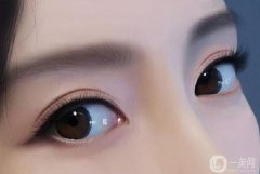 年輕割雙眼皮老了之后會(huì)很丑嗎?