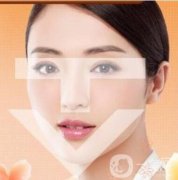 T字3D輪廓整形打造立體夏日下頜線輪廓