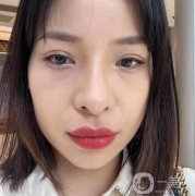 眼袋的形成讓我脾氣變得暴躁起來(lái)，父母說(shuō)我是因?yàn)橥ㄏ蛘呤菒?ài)哭才發(fā)生的