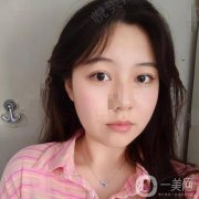 大家都說(shuō)臉上有疤的人，小時(shí)候一定會(huì)皮，我爸媽都管不住我
