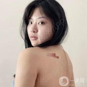 對(duì)于我們這種身上有疤的人來(lái)說(shuō)，每一塊地方都是一個(gè)特別痛苦的回憶