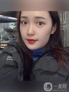 大家都讓我出一期熱瑪吉的視頻，但是我還沒有做過熱瑪吉的手術