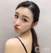 除皺:面診的時(shí)候，醫(yī)生也是的專業(yè)，說出了本人的問題，結(jié)合問題做出了方案