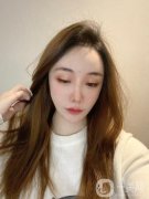 注射完了玻尿酸以后，我的臉有一些腫脹感，但不是很嚴重，當時我的臉上還貼