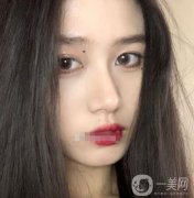近聽我的朋友說(shuō)，熱瑪吉特別的火，他是一個(gè)抗衰老的項(xiàng)目