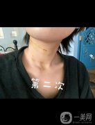 脖子真的就是女人的第二張臉，所以大家在保養(yǎng)自己臉蛋的同時，也不要忘記自