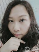 雙眼皮恢復(fù)這段時間我也收到了醫(yī)生很大的關(guān)懷，手術(shù)做的很快，大概不到兩個